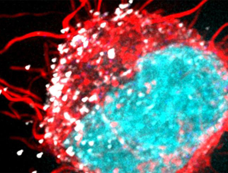 HIV-cells closeup 