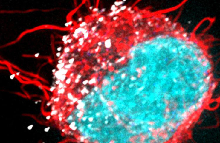 HIV-cells closeup 