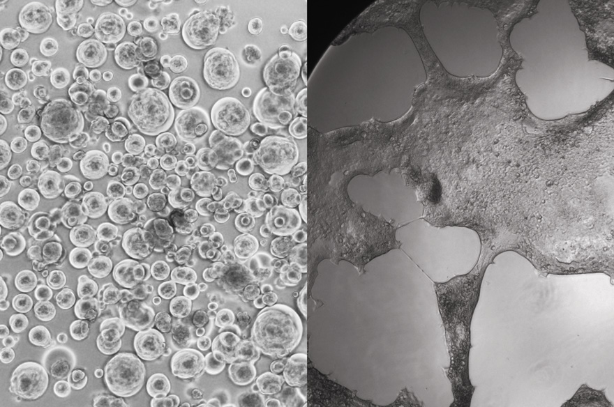 R-20 supercharged cells infected by Delta (Left) and Omicron (right).