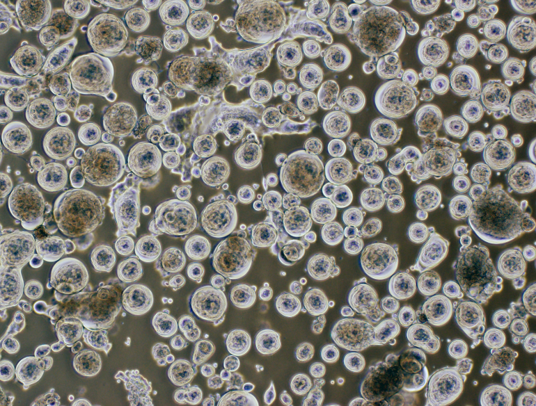 COVID cells B.1.351 variant