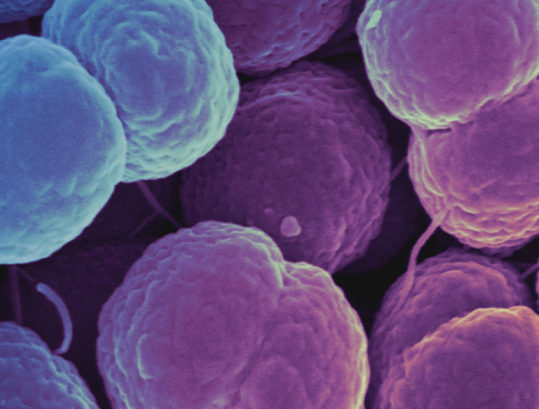 Gonorrhoea cells. Credit: National Institute of Allergy and Infectious Diseases, National Institutes of Health.