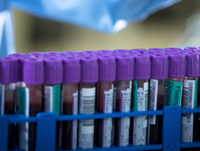 Blood specimens plasma. Credit: Lifeblood