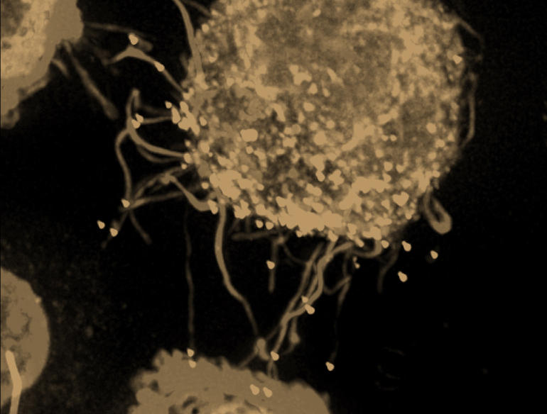 Micrograph image of gold coloured HIV cell on black background. Credit: Kirby Institute/Stuart Turville