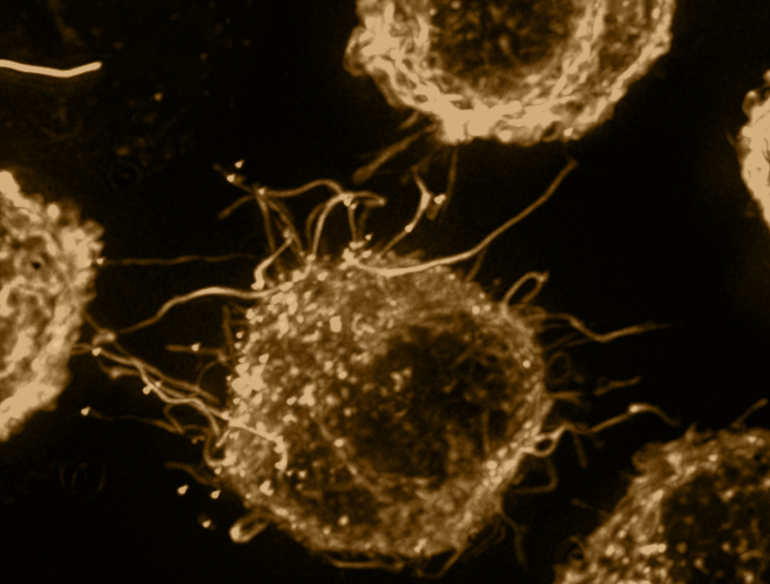 Micrograph image of gold coloured HIV cells on black background. Credit: Kirby Institute/Stuart Turville