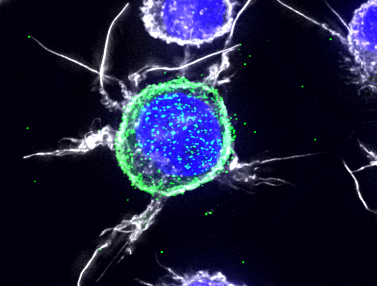Micrograph of two HIV cells, coloured blue. Credit: Stuart Turville/Kirby Institute