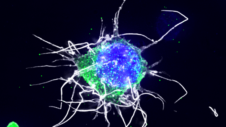 HIV-1 infected resting CD4 cell with an anti-HIV therapeutic (red) in the nucleus (blue) that was delivered by a nanoparticle. Virus is shown in green.