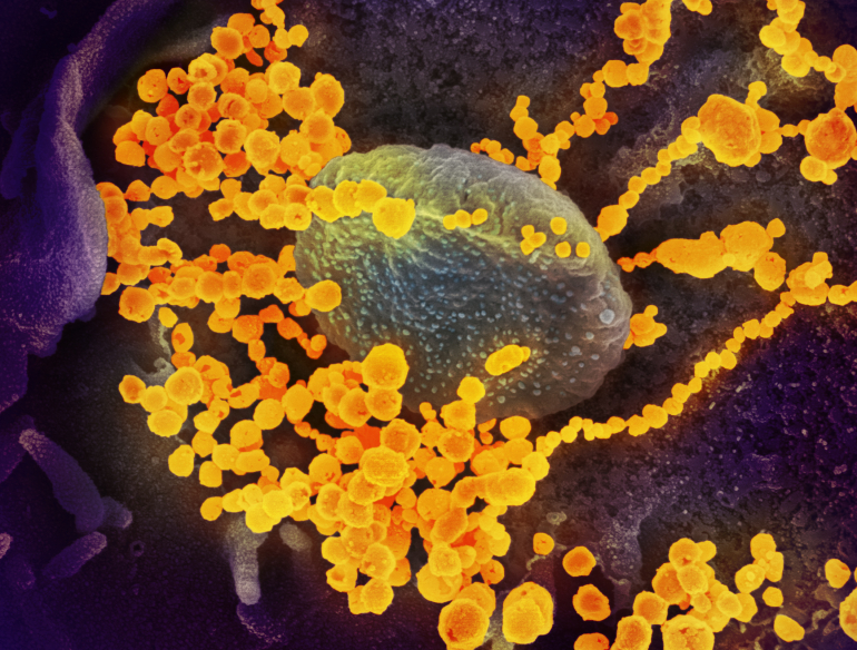 Electron microscope image of novel coronavirus SARS-CoV-2. Credit: NIAID