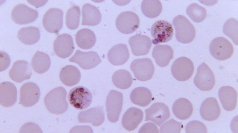 Photomicrograph of two Plasmodium malariae schizonts, malaria cells. Credit: CDC/Dr Mae Melvin