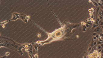 Micrograph of SARS-CoV-2 Omicron BA1 covid variant, 2-3 days post infection. Credit: Kirby Institute/Stuart Turville