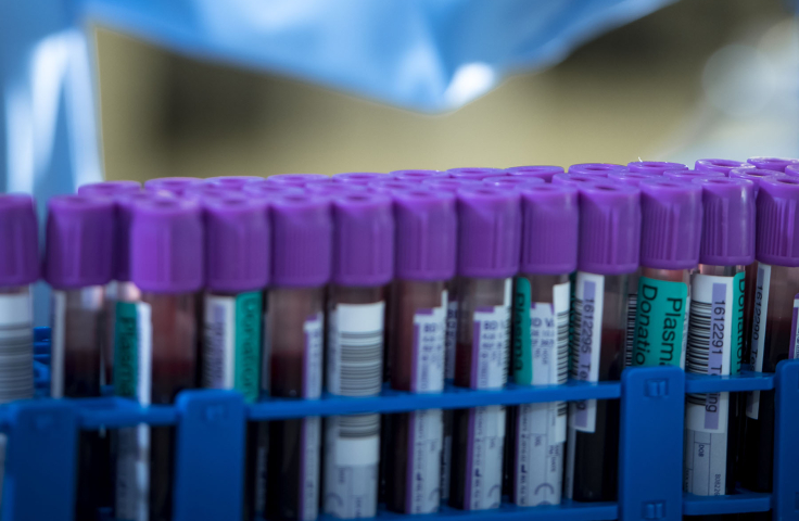 Blood specimens plasma. Credit: Lifeblood