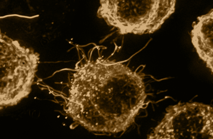 Micrograph image of gold coloured HIV cells on black background. Credit: Kirby Institute/Stuart Turville