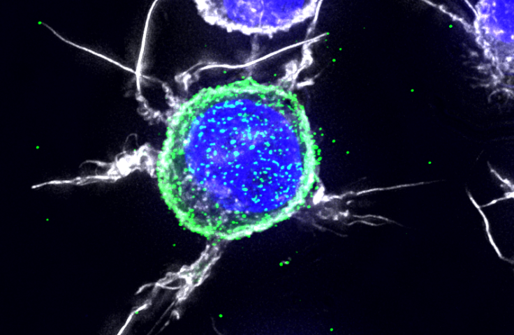 Micrograph of two HIV cells, coloured blue. Credit: Stuart Turville/Kirby Institute
