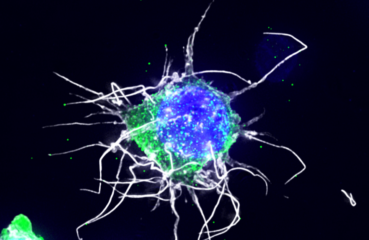HIV-1 infected resting CD4 cell with an anti-HIV therapeutic (red) in the nucleus (blue) that was delivered by a nanoparticle. Virus is shown in green.